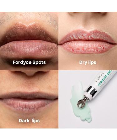 Abera Fordyce Cream Advanced Formula with HPR (Next-Gen Retinoids), Fordyce Spot Remover For Lips, All-day Moisturizing, Help Improve Dry, Chapped and Dark Lips, For Sensitive Lips (0.7 Oz) Set 1 - Buy Online on GoSupps.com