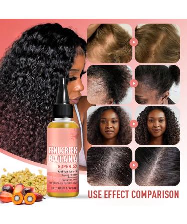 Batana Oil Pure Super 5X Batana Oil for Hair Growth Veganic Natural Hair Growth Oil Repair Damaged Hair & Skin Effective Against Regional Alopecia Promote Hair Regrowth (Batana hair oil) - Buy Online on GoSupps.com