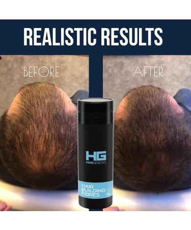 Hair Genetics Black Hair Fibres (50g) - Hair Loss Treatment for Thinning Hair - Buy Online on GoSupps.com