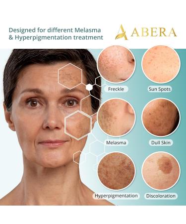 Abera Melasma Serum with Niacinamide & Hyaluronic Acid | Dark Spot Corrector | Melasma Treatment for All Skin Types - Set of 3 (0.68 fl. Oz - Buy Online on GoSupps.com