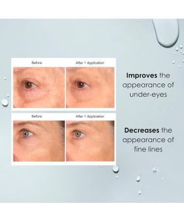 Consult Beaute Real-EYEZ-ATION Tinted Instant Firming Eye Gel - For Puffy Under Eyes - Temporary Eye Lid Lift - Illuminating - For Collagen and Elastin Production - Women and Men - .5 Fl. Oz - Buy Online on GoSupps.com