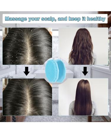 2-in-1 Scalp Massage Brush & Peeling Body Brush for Hair Growth - Soft Silicone Suitable for All Skin Types Blue - Perfect for Kids Women & Men (10.5cm) - Buy Online on GoSupps.com