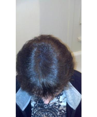 Hair Loss Concealer - Light Brown Hair Building Fibers 23g | Best Hair Thickening Solution for Men & Women - Buy Online on GoSupps.com