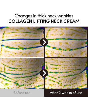 LAGOM Collagen Lifting Neck Cream with Massage Roller for Jawline and Face, Wrinkle Care, Korean Skincare 1.69 Fl Oz - Buy Online on GoSupps.com