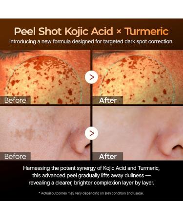 Dr.Melaxin Peel Shot Kojic Acid Turmeric Serum 80ml For Dark Spot Care Exfoliaing Dead Skin Korean Skin Care All Skin - Buy Online on GoSupps.com