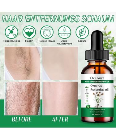 Znnhnn Cyperus Rotundus Oil for Hair RemovalNatural Pure Cyperus Rotundus Oil for Reducing Body Hair Growth and Hydration 60 ml * 2 - Buy Online on GoSupps.com