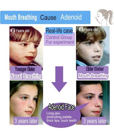 Mouth Tape for Sleeping - 60 Sheets | Nose Breathing Sleep Strips | Breathable Non-Woven Fabric Sleep Aids - Buy Online on GoSupps.com