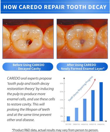 CAREDO Cavity Repair Toothpaste Set for Adults 16g Pulpitis Ointment for Tooth Decay Pain & 100g Hydroxyapatite Toothpaste for Home Cavity Repair Fluoride Free - Buy Online on GoSupps.com