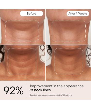 ALPYN Super Sculpt Serum Face & Neck with Tri-Peptide Firming Complex 1.7 oz - Buy Online on GoSupps.com