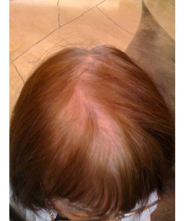 TIPTOP Confidence Building Fibers (10g Auburn) - Boost Hair Volume & Conceal Thinning Hair - Fast Worldwide Shipping - Buy Online on GoSupps.com