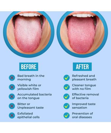 Buy Stainless Steel Tongue Cleaner & Scraper - Cure Bad Breath | Hygienic & Medical Grade for Adults & Kids | 2 Pcs 30g - Buy Online on GoSupps.com