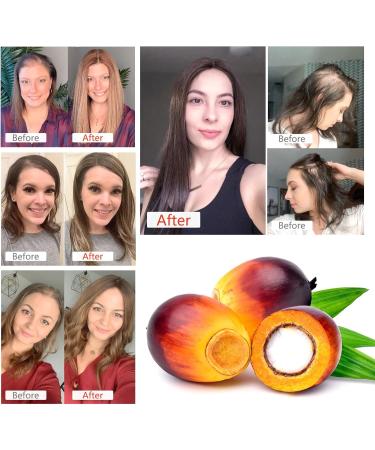  CCKULOOB Pure organic Batana oil for hair growth scalp care and moisturizing - Prevents hair loss (120 ml) - Buy Online on GoSupps.com