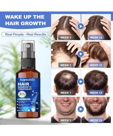Buy 5% Minoxidil Hair Growth Serum | Hair Regrowth Treatment for Men & Women | Thicker Stronger Hair | 60ml - 1 Month Supply - Buy Online on GoSupps.com