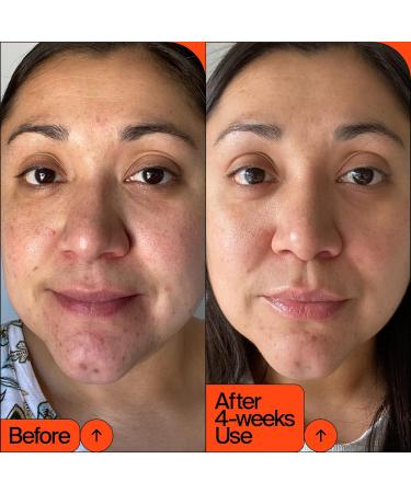 Youth To The People 15% Vitamin C + Clean Caffeine Energy Serum - Reduce Puffiness - Hydrating Antioxidant Face Serum - Vegan Skincare (1 oz) - Buy Online on GoSupps.com