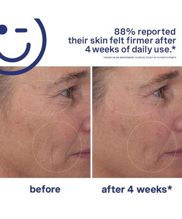 Kate Somerville Breakout Dream Team: EradiKate 3% Sulfur Daily Foaming Cleanser Acne Treatment 4 oz. and Mega-A Skin Transforming Anti-Aging Serum with Retinal 1 oz. - Buy Online on GoSupps.com