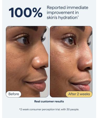 Remedy for Rich Moisture | Barrier Repairing Rich Cream Moisturizer for Normal to Dry Skin | Quadruple Ceramide Complex Peptides Squalane Glycerin | By Dermatologist Dr. Shah 1.7 fl. oz - Buy Online on GoSupps.com