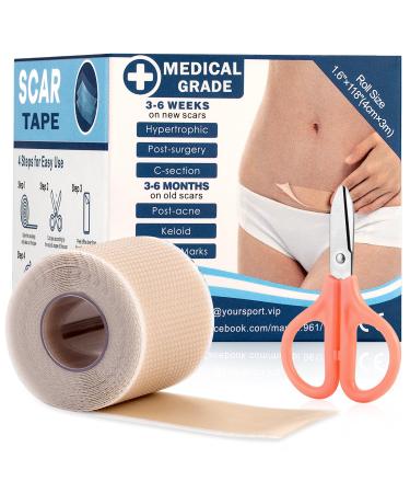 LOKFAM Silicone Scar Tape (Silicone Scar Sheets) for Surgical Scars Tummy Tuck Scar Eraser Keloid Scars from Burns Cuts and Injuries Reusable Scar Removal Advanced Scar Treatment Tape-1.6 *12  Roll LOK-CT