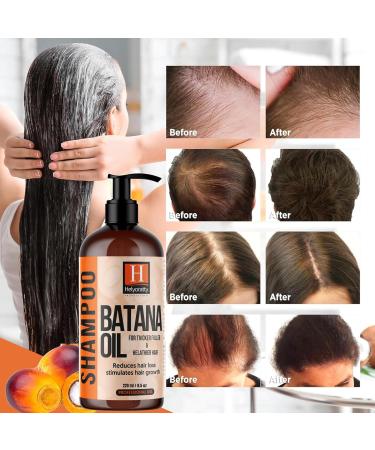 Batana Oil for Hair Growth | Thinning Hair Shampoo & Mask - 3-in-1 Set with Rosemary Rice Water Biotin & Clove Oil - Dr. Sebi - Buy Online on GoSupps.com