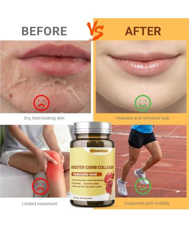 QIFEISHANKA Rooster Comb Collagen Natural Hyaluronic Acid Supplement for Joint Support Mobility & Skin Hydration 120mg 60 Capsule - Buy Online on GoSupps.com