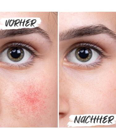 Buy 100ml Bio Vitamin C Serum with Hyaluronic Acid - Vegan Anti-Aging Formula for Radiant Skin | Made in Germany - Buy Online on GoSupps.com