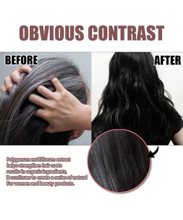  Zankie Natural Grey Hair Removal Soap - Multiflorum Shampoo Bar Organic Grey Reverse Shampoo Bar Shampoo Hair Darkening Bar Shampoo Hair Care Soap Shampoo - Buy Online on GoSupps.com