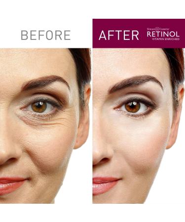 Retinol Skin Brightener | Original Brand | Tone Corrector with Plant Extracts | Vitamin A, C & E - Buy Online on GoSupps.com
