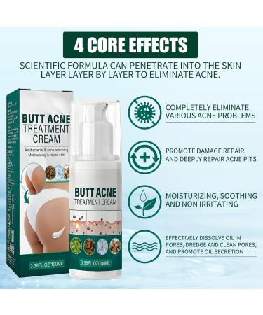 Cr me nettoyante contre l'acn pour les fesses et les cuisses 100 ml de cr me d'acn pour les fesses cr me nettoyante anti-acn cr me anti-boutons sur les fesses limine les boutons et les taches - Buy Online on GoSupps.com