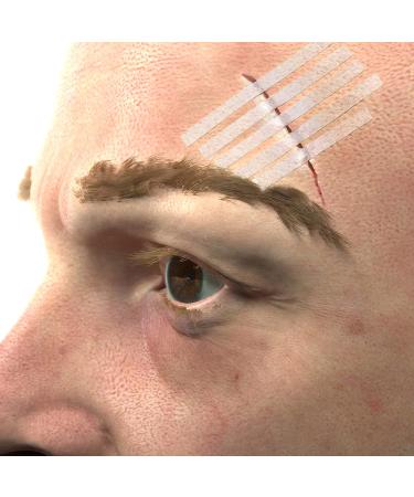 JFA Medical Set of 250 Wound Closure Strips | Suture Material & Stapling Plasters - 3x75 mm for Efficient Wound Care - Buy Online on GoSupps.com