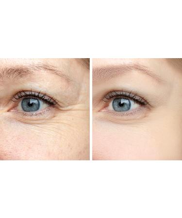 Advanced Firming Eye Cream with Matrixyl 3000 | Reduce Wrinkles & Fine Lines | Organic Anti-Aging Formula | Boost Collagen & Rejuvenate Skin - Buy Online on GoSupps.com