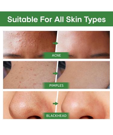 Hello Sunshine Green Tea Mask Stick Blackhead Remover - Purifying Deep Pore Cleansing 2 Pack - Buy Online on GoSupps.com