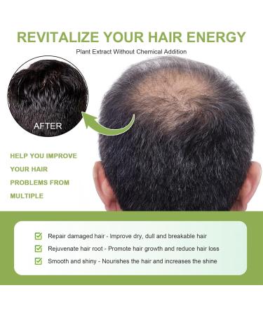 Amla Hair Oil Indian Amla Oil for Hair Amla Oil for Hair Growth Scalp Oil Nourishes Scalp Indian Hair Oil for Skin and Face Amla Essential Oil Hair Growth Oil for Women for Long Soft Strong Hair 60ml - Buy Online on GoSupps.com