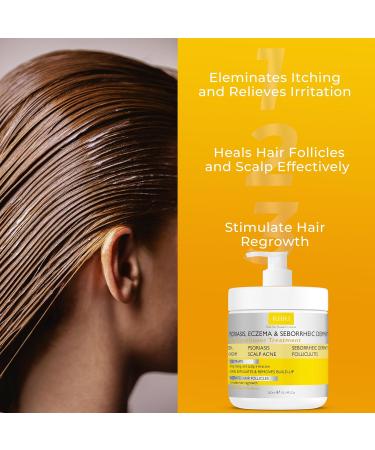 Antifungal Psoriasis Deep Conditioner Treatment for Eczema & Seborrheic Dermatitis | Soothes Itching Repairs Scalp Strengthens Hair & Stimulates Regrowth | Shop Internationally - Buy Online on GoSupps.com