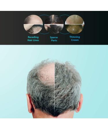 Laser Hair Growth System Cap - FDA Cleared Hair Regrowth Hat for Men & Women | 8000C Laser Therapy - Buy Online on GoSupps.com
