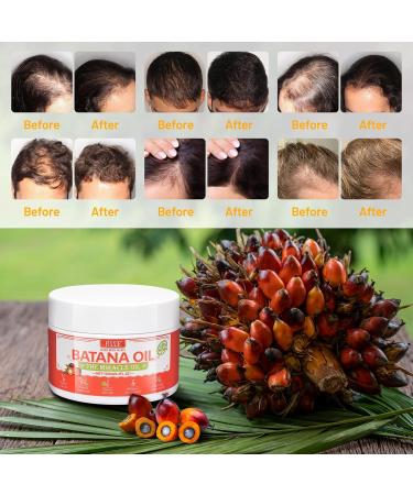 Raw Batana Oil Batana Cream For Hair Growth 120ml 100% Pure Natural Raw Batana Oil from Honduras Unrefined and Organic Hair Mask Prevent Hair Loss Promote Hair Thickness for Women & Men - Buy Online on GoSupps.com