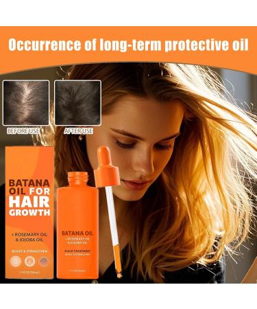  Mimoqk Hair Oil Growth Oil Ultra-Hydrating Formula Balances Moisture Fortifies Fragile Strands While Diminishing Breakage and Dryness Scalp Treatments for Invigorating Massage - Buy Online on GoSupps.com