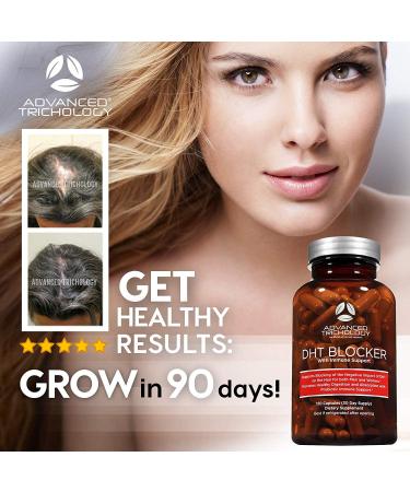 DHT Blocker Hair Growth Supplement for Genetic Thinning | Approved by American Hair Loss Association | 20 Years of Experience in Hair Loss Treatment Clinics - Buy Online on GoSupps.com
