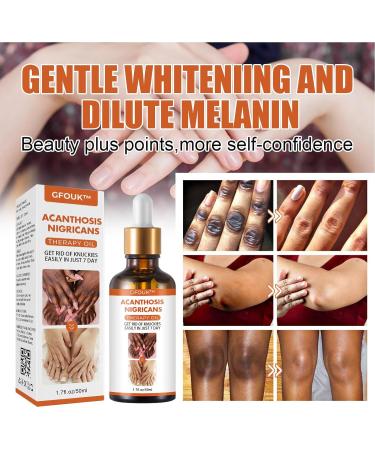 Skin Bleaching Serums | Dark Skin Permanent Whitening Lightening | Armpit Bleaching Serums for Women Supercharged Face Serums Skin Lightening Bleaching Oil Black Spot Corrector Remover for Face 2Pcs - Buy Online on GoSupps.com