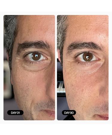 Geologie Dark & Puffy Under Eye Cream | Fight Dark Circles & Puffiness | 10 ML Daily Eye Cream with Kojic Acid, Caffeine & Hyaluronic Acid | 90 Day Supply | 1 Count - Buy Online on GoSupps.com