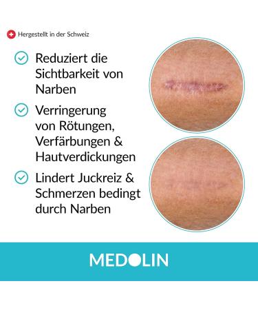 Medolin Scar Ointment - Reduce Scar Visibility | Certified EU Scar Angel | Easy Application 19g - Buy Online on GoSupps.com