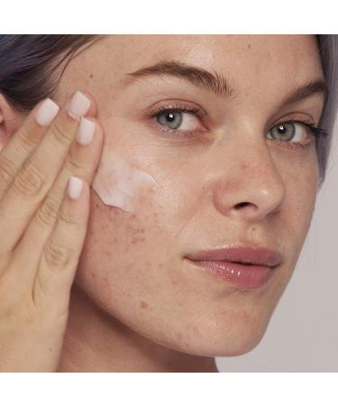 Neutrogena Stubborn Acne AM Treatment 2.0 oz - Effective Acne Relief - Buy Online on GoSupps.com