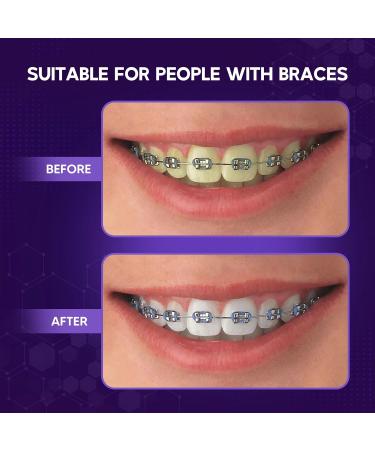 Abera Purple Teeth Whitening Foam | Instant Whitening & Colour Corrector | Cleans Aligners Braces & Freshens Breath | Natural Peroxide-Free Formula (5.07 Fl Oz) - Buy Online on GoSupps.com