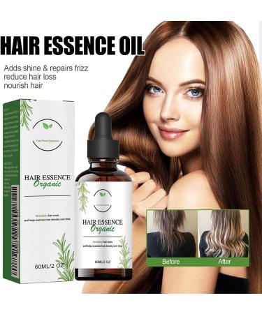 Natural Hair Growth Oil Hair Regrowth Treatment Hair Growth Serum Hair Growth Oil Hair Regrowth Extract Oil for Women Men Natural Thinning Hair & Nourish Hair Follicles - Buy Online on GoSupps.com