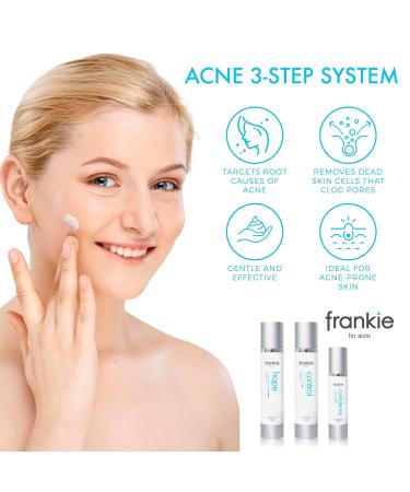 Frankie for Acne 3 Step Skin Care Set - Charcoal Face Wash Salicylic Acid Exfoliator & Niacinamide Moisturizer - 60 Day Supply | International Shipping Available - Buy Online on GoSupps.com