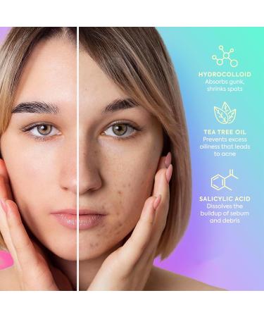 VelvetGlow 240 pi ces de patchs toiles pour le visage patchs hydrocollo des pour les boutons avec huile d'arbre th comme cadeau de f te pour couvrir les boutons et les imperfections de la peau - Buy Online on GoSupps.com