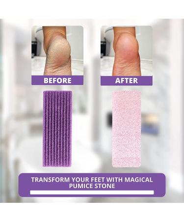 Purple Love Natural Pumice Stone - Professional Exfoliating Rock for Feet, Hands & Body - Dead Skin & Callus Removal - 2-in-1 Scrubber - Buy Online on GoSupps.com