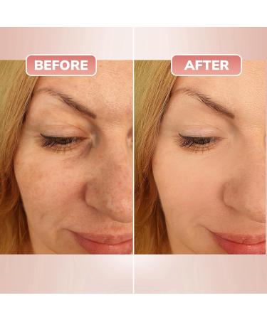 McG Melanogen Dark Spot Corrector Cream - Anti Dark Spot Cream for Face Body Underarms Bikini Area - Lumisphere & Hentowhite for Instant Effective - Glowing Skin for Women and Men - SPF20/30ml - Buy Online on GoSupps.com