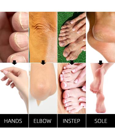 Rose Scented Paraffin Wax Refill Blocks 4 lbs - Bulk 6 Pack for Paraffin Baths - Relieves Arthritis Pain & Hydrates Hands/Feet - SUBUCKOOL - Buy Online on GoSupps.com