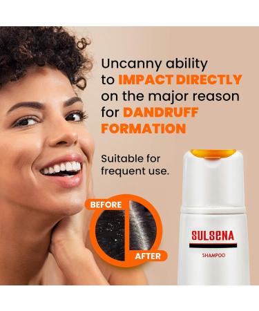 Amalgame Luxe Ltd 3 x SULSENA ANTIDANDRUFF SHAMPOO SOOTHING CALMING DEEP CLEANSING EFFECTIVE ANTI DANDRUFF Shampoo with Selenium Sulfide for All Hair Types Set 3 for MEN and WOMEN 450 ml Shampoo Set x3 - Buy Online on GoSupps.com