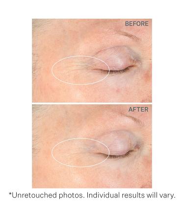 StriVectin Peptight Serum - Lift & Tighten Face & Eyes, Reduce Fine Lines - Buy Online on GoSupps.com