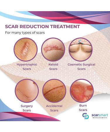 Scar Smart Silicone Sheets - Treatment for Surgical Scars, Burns, Stretch Marks, Acne & Keloids - Buy Online on GoSupps.com